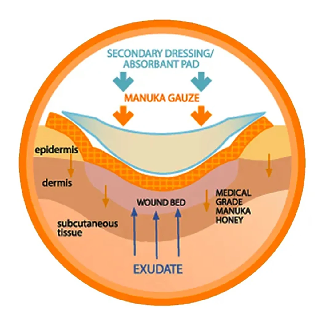 Manuka Honey Medical Wound Care Surgical Gauze Dressing
